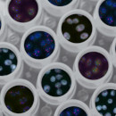 Fresenius Kabi and Celltrion Launch Prolia® / Xgeva® (denosumab) Biosimilars Conexxence™ / Bomyntra™ and Stoboclo® / Osenvelt®